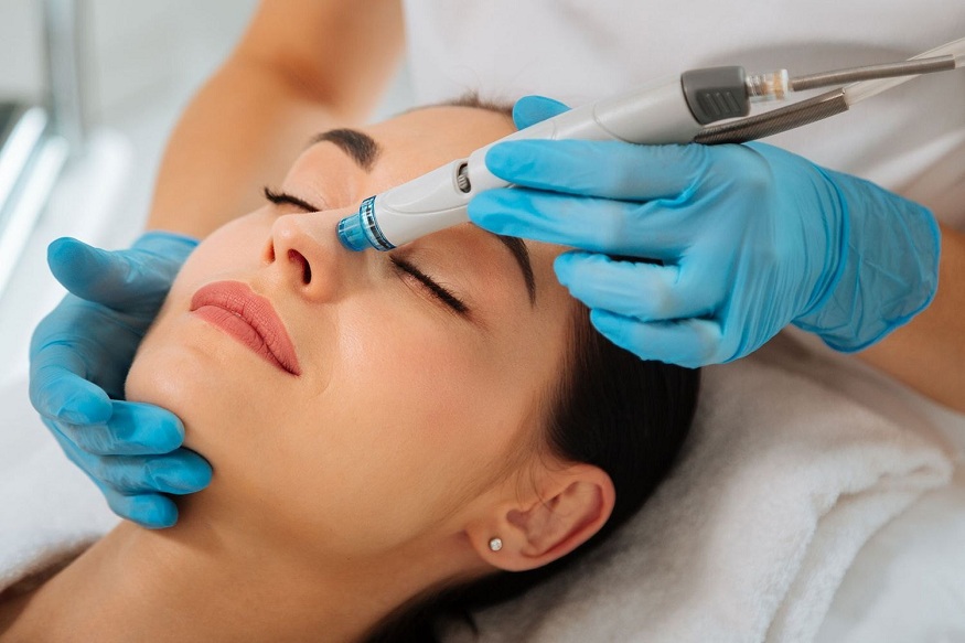 open pores treatment